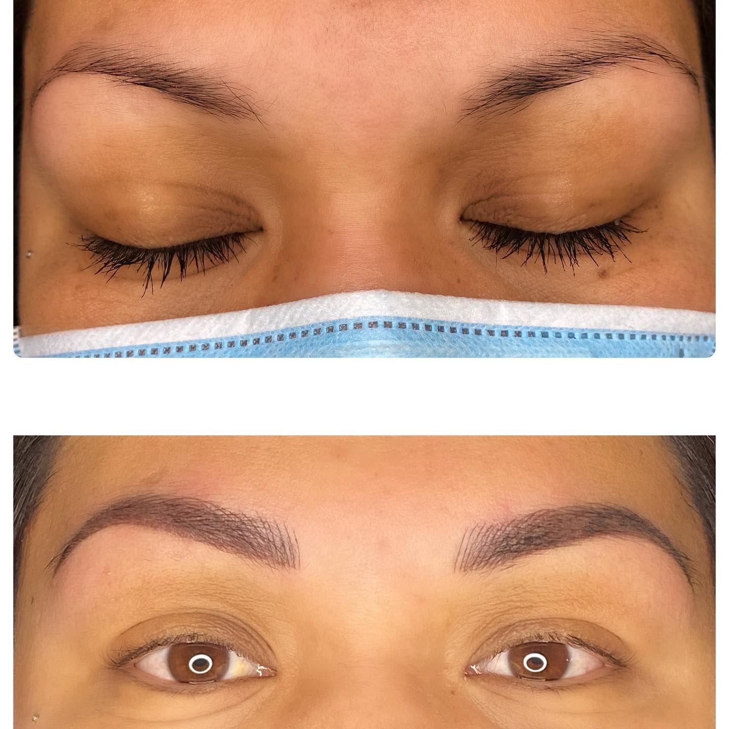 Front views of brows before and after treatment